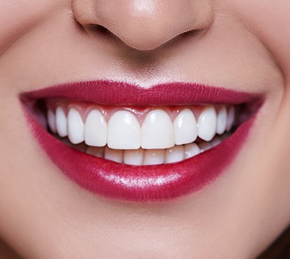 Closeup of smile after cosmetic gingival surgery