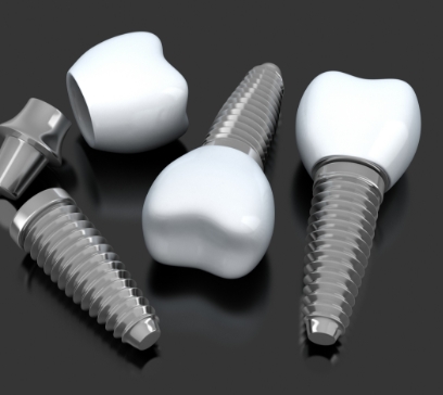 Three animated dental implant supported replacement teeth