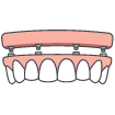 Animated all on four dental implant supported denture placement